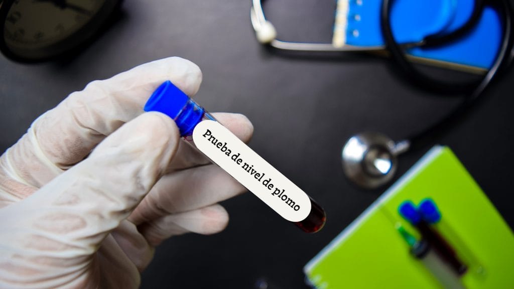 Prueba de sangre de plomo